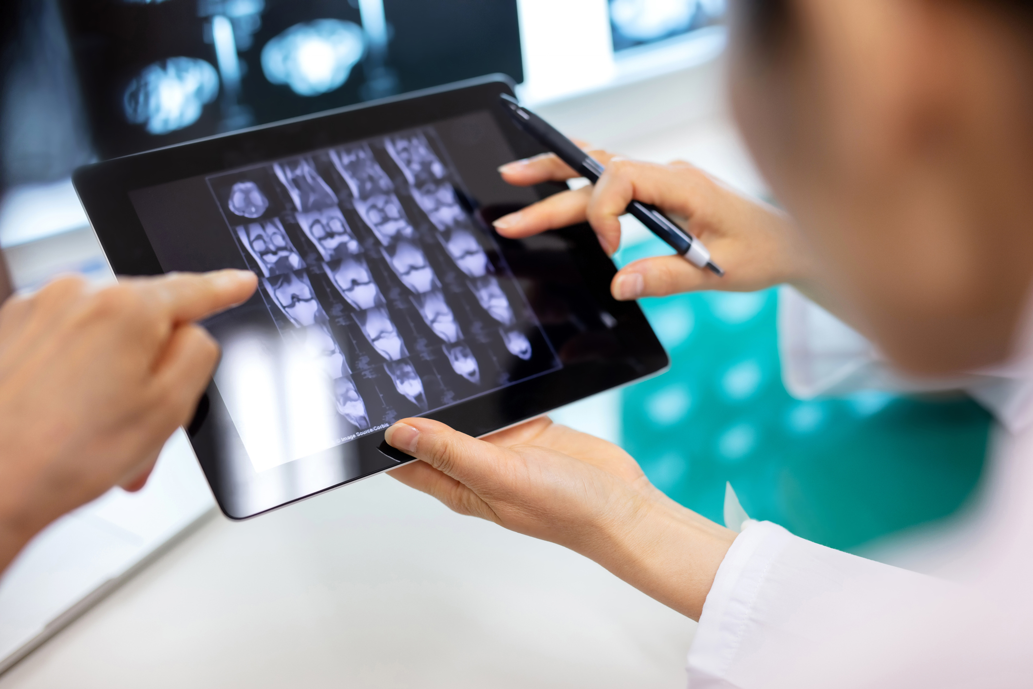 Cropped image of healthcare workers and patient discussing over medical x-ray in hospital